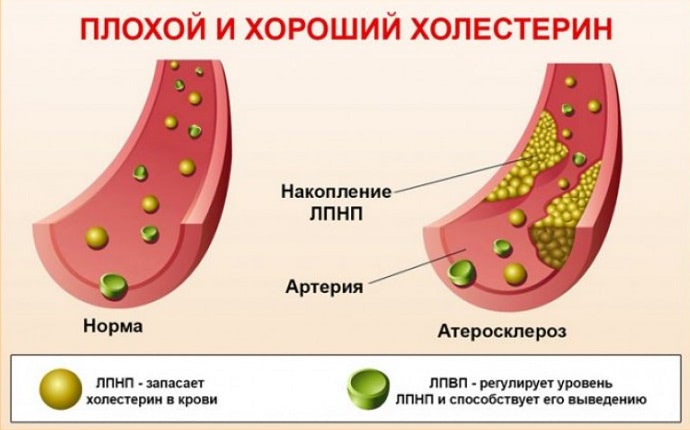 Избыток насыщенных жиров и холестерина в карниворе